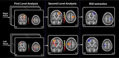 Is the Blood Oxygenation Level-Dependent fMRI Response to Motor Tasks Altered in Children After Neonatal Stroke?